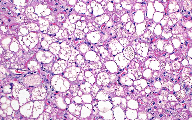 Light micrograph of brown fat that looks like white bubble structures.