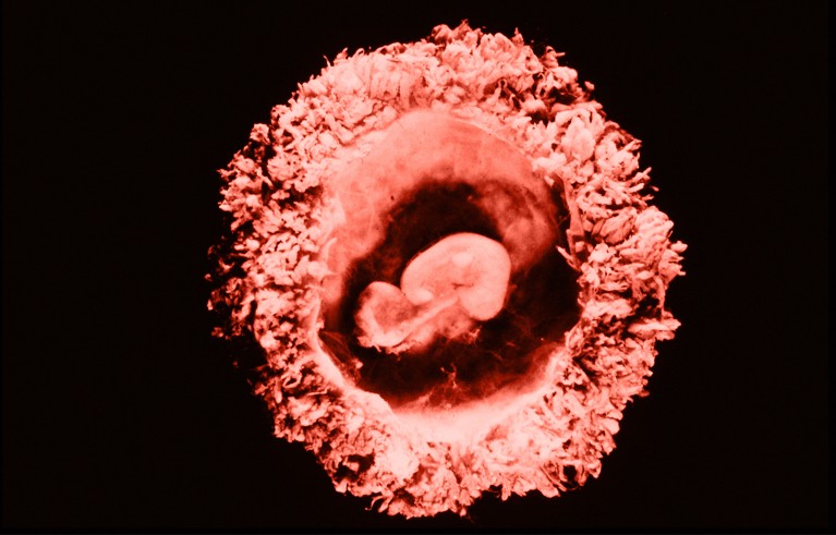 Microscopic photograph showing a developing embryo curled inside a circular, textured structure against a black background.