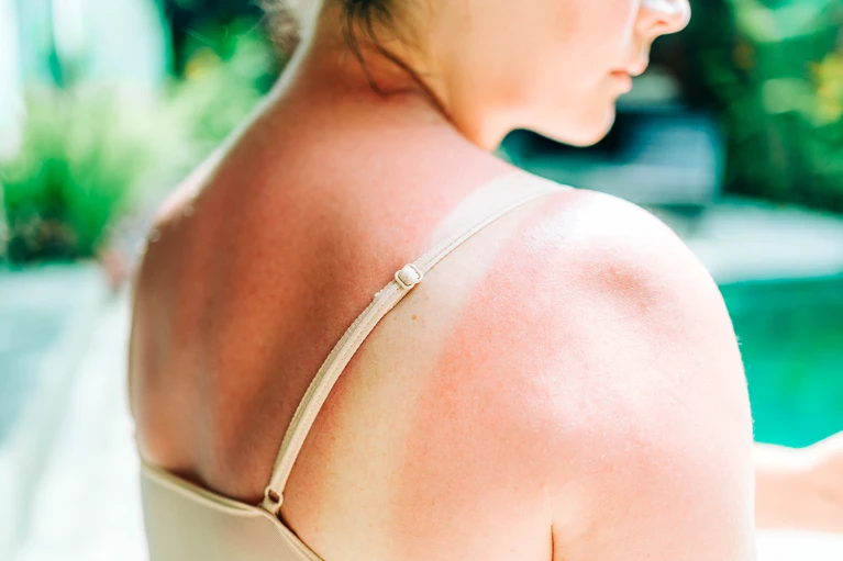 Moderna mRNA vaccine almost halves the risk of skin cancer returning