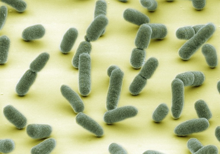 Coloured scanning electron micrograph (SEM) of Escherichia coli bacteria