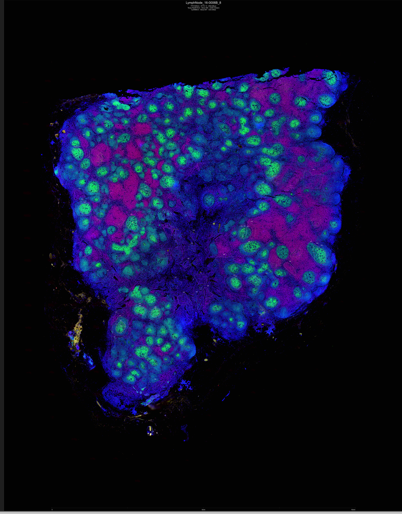 Spatial Biology Lights Up Regional Complexity In Tissues And Cells