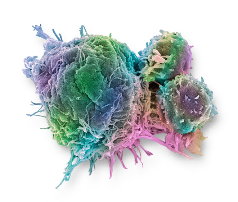 The Path To Personalized Cancer Immunotherapy