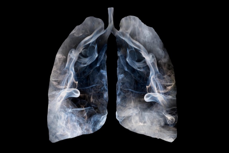 Why does smoking make your lungs go black?