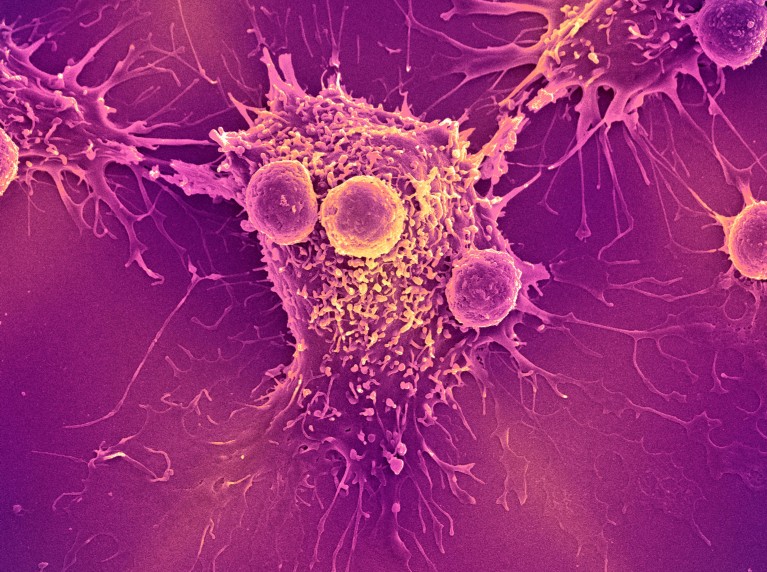 Una cellula tumorale frastagliata viene attaccata da 3 linfociti più piccoli