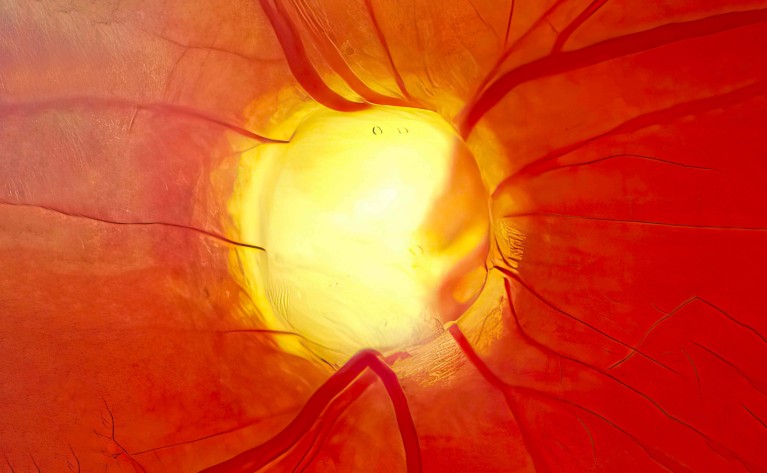 The hunt for cell and gene therapies for eye diseases