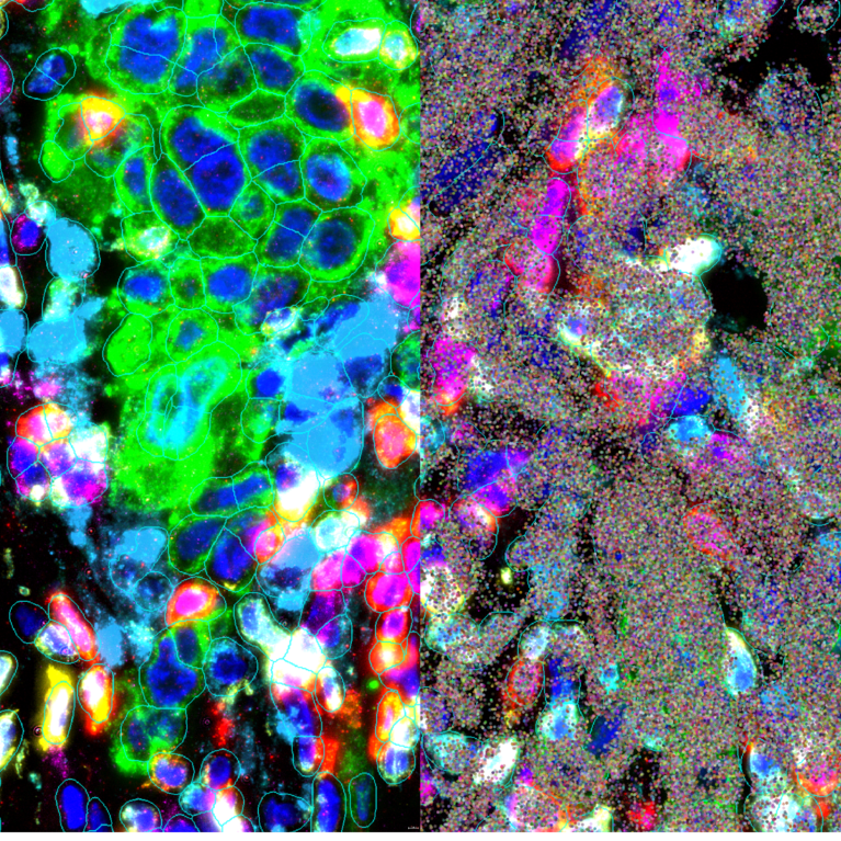Spatial imaging reveals biology’s hidden layers