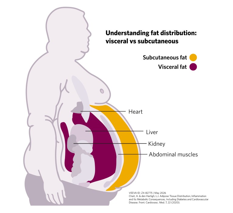 Obesity redefined: The research shift from body size to biological ...
