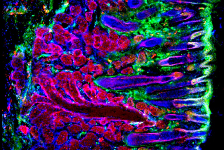 Imagen de microscopía de fluorescencia de un corte transversal del margen del párpado. Los folículos de las pestañas, de color púrpura, se extienden hacia abajo desde la superficie, mientras que las glándulas de Meibomio, productoras de sebo y de color rojo, se encuentran debajo. El tejido teñido de verde delimita las estructuras circundantes.