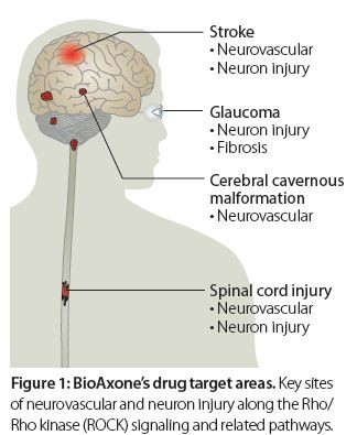 Neurovascular Market to Benefit from Fast-paced Technology - Brain