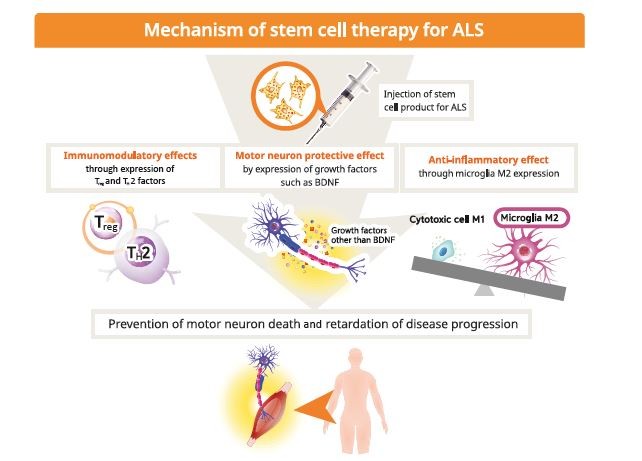 韩国批准用于治疗ALS的干细胞疗法