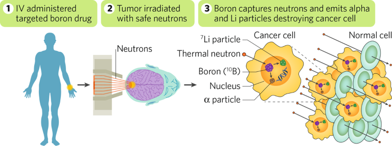 TAE Life Sciences’ next-generation BNCT for cancer