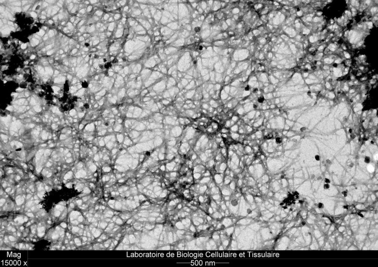 Microscopic image of amyloid aggregates