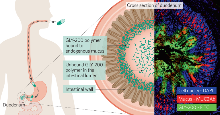 Graphic demonstrating the mechanism of Glyscend's drug candidate GLY-200 alongside a representative histology image