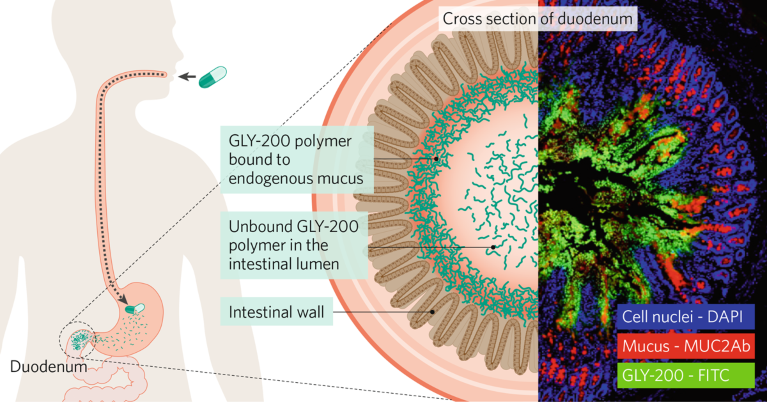 Cross-section of the body showing how Glyscend's drug candidate is taken orally via capsule