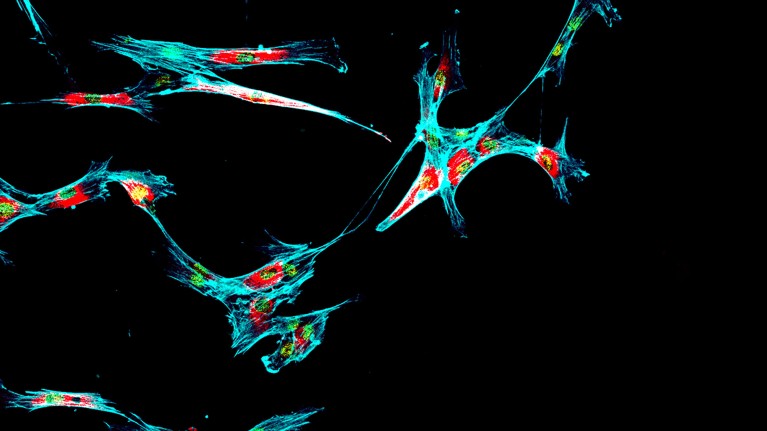 Immunofluorescence of multiple human tumor metastatic cells growing in tissue culture