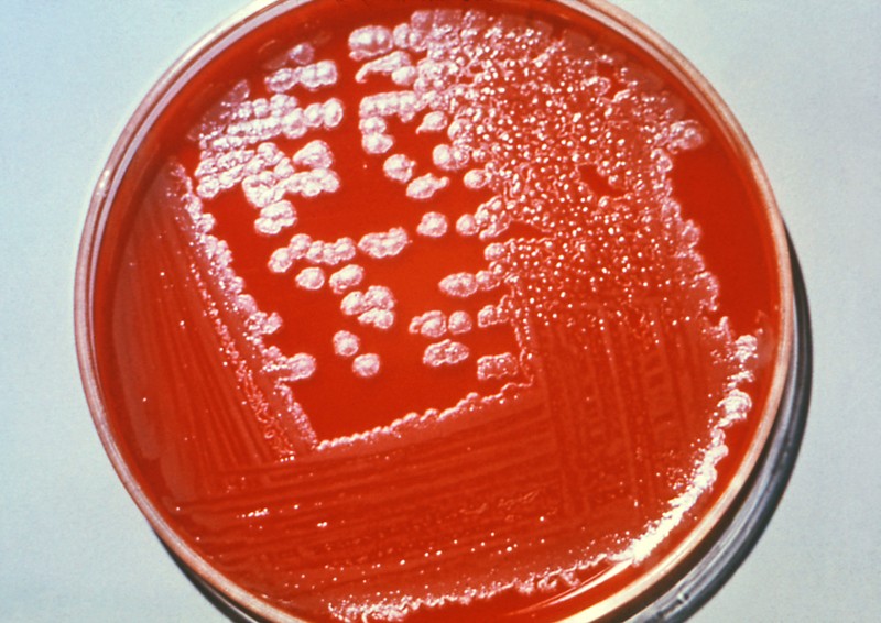 Anthrax spores in petri dish