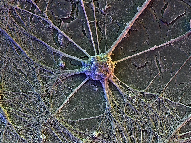 A nerve cell is pictured in rainbow colours on a grey background: a central blob of matter with tendrils extending outwards.