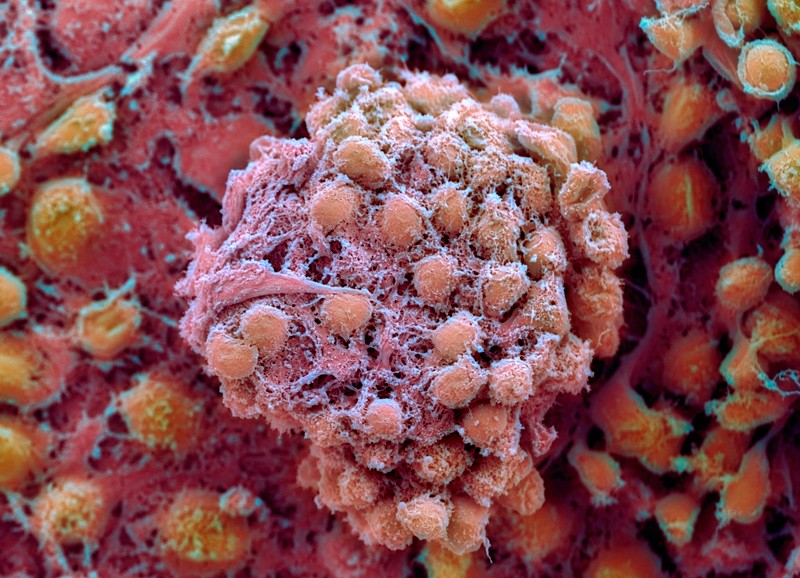 Coloured scanning electron micrograph of human embryonic stem cells