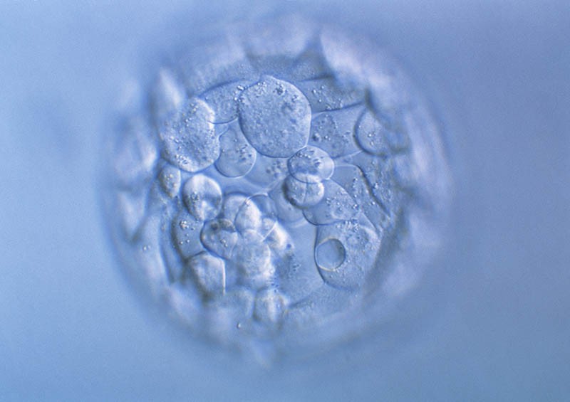 Blastocyst embryo