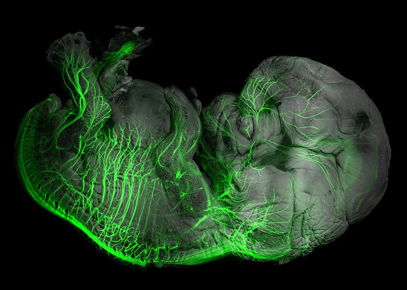3D image of peripheral nerves in an eight week old human embryo