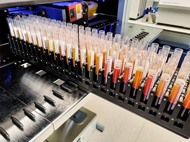 Blood samples in testubes at the Estonian biobank in Tartu