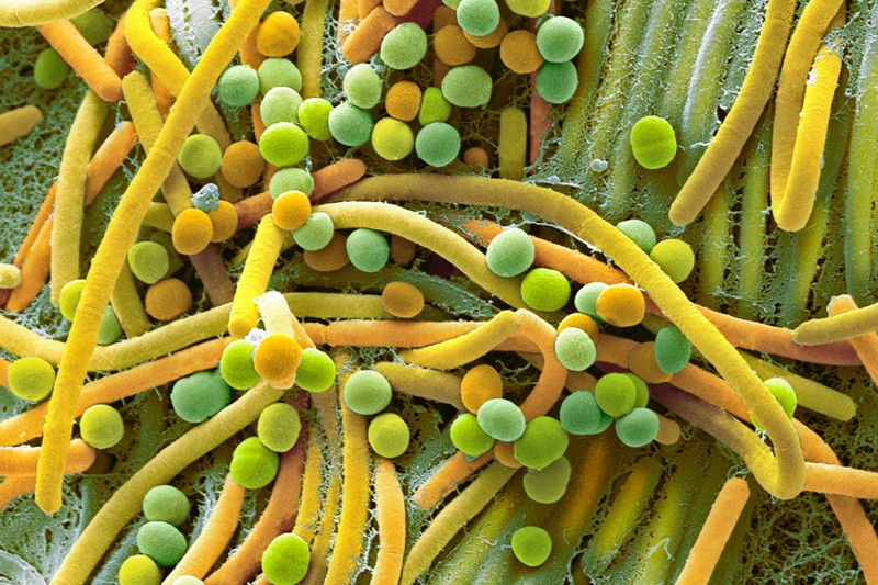 Scanning electron micrograph of human faecal bacteria