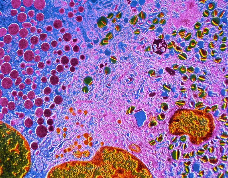  Falschfarben-TEM zeigt Zellen einer Insel von Langerhans, der endokrinen Komponente der menschlichen Bauchspeicheldrüse.