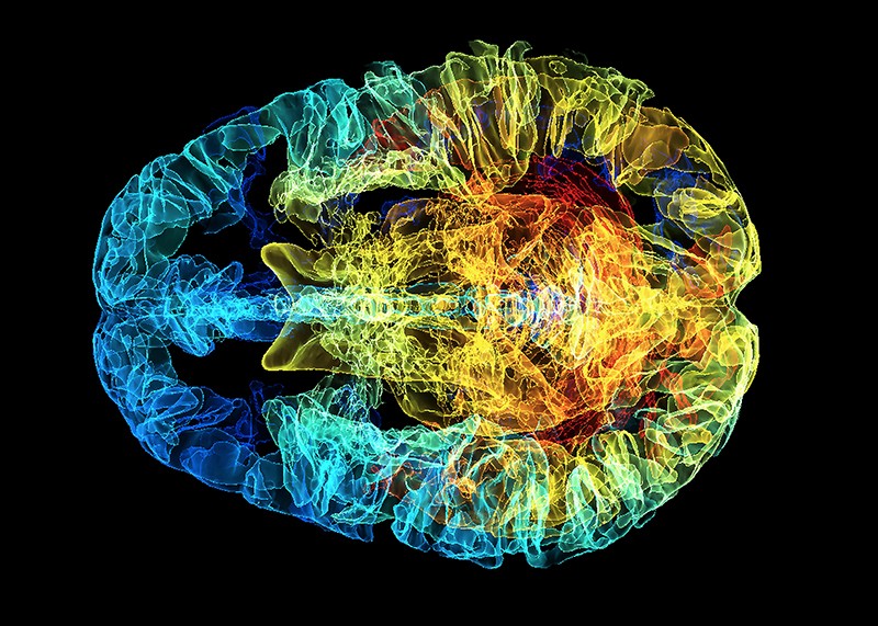 A coloured 3D magnetic resonance imaging (MRI) scan of a human brain.