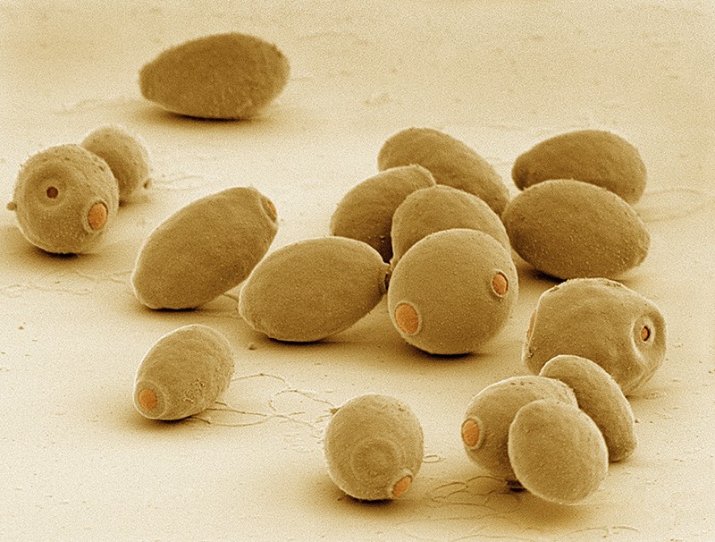 Coloured scanning electron micrograph (SEM) of cells of brewer's, or baker's, yeast (Saccharomyces cerevisiae).