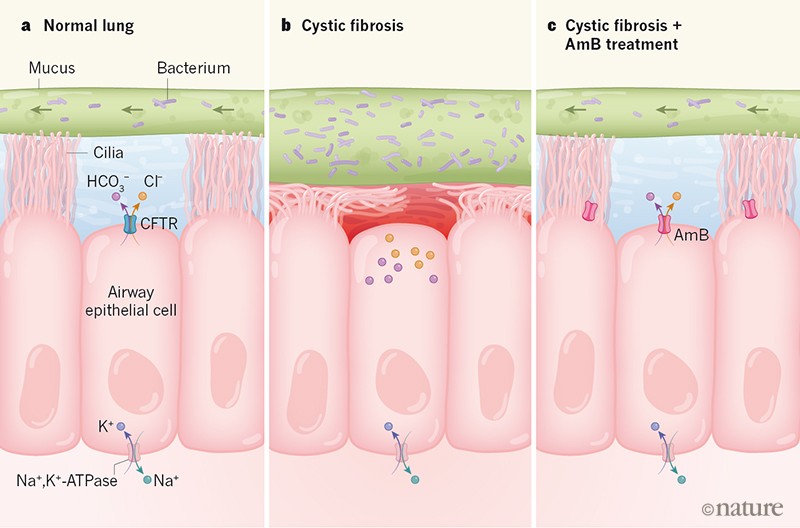 Pore Forming Small Molecules Offer A Promising Way To Tackle Cystic Fibrosis