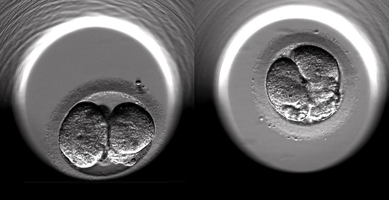 The cell-division of two fertilized human embryos