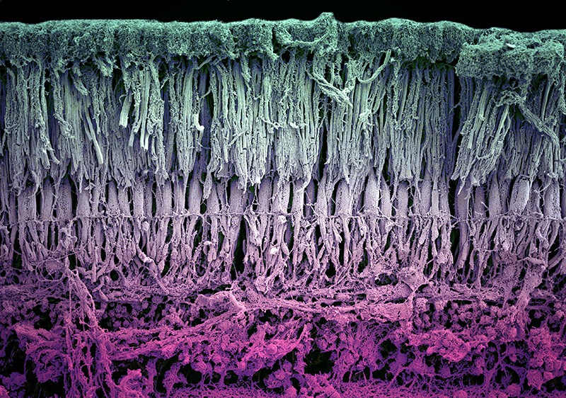 A scan of the retina's structure showing the photoreceptors, blood vessles and nerves