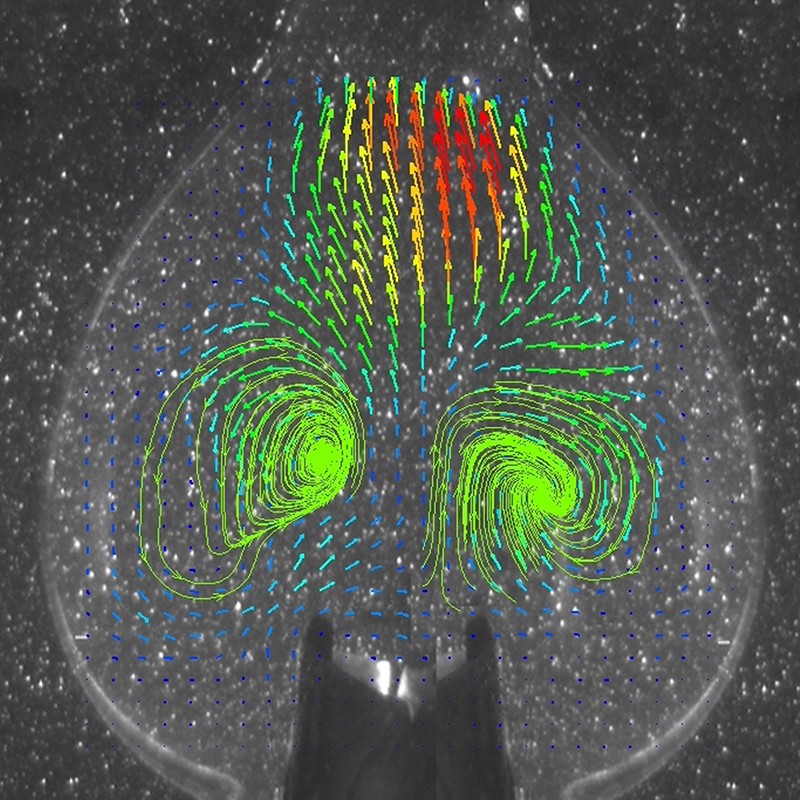 Cross-section through a glass model of a heart valve. Multicoloured arrows show how water moves through it.