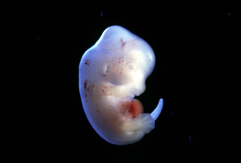 Close-up of a rat embryo at 15.5 days gestation