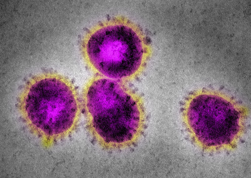 EM Coronavirus, causing SARS