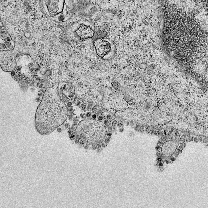 Thin-section electron micrographs of the 2019 novel coronavirus grown in cells at The University of Hong Kong.