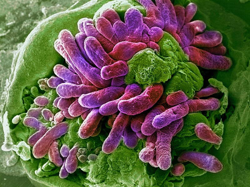 Micrograph of villi on the small intestine