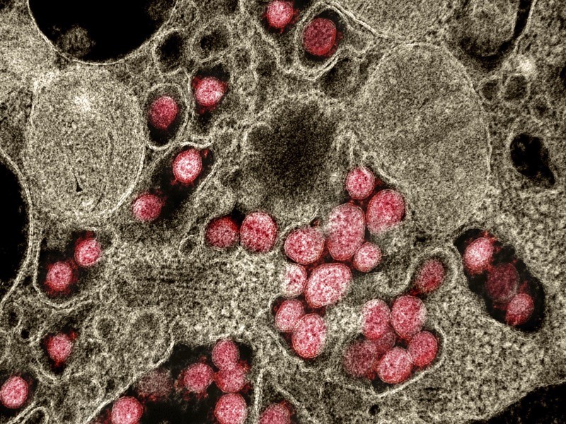 Coloured TEM of SARS-CoV-2 coronavirus particles (red) isolated from a patient with the disease Covid-19.