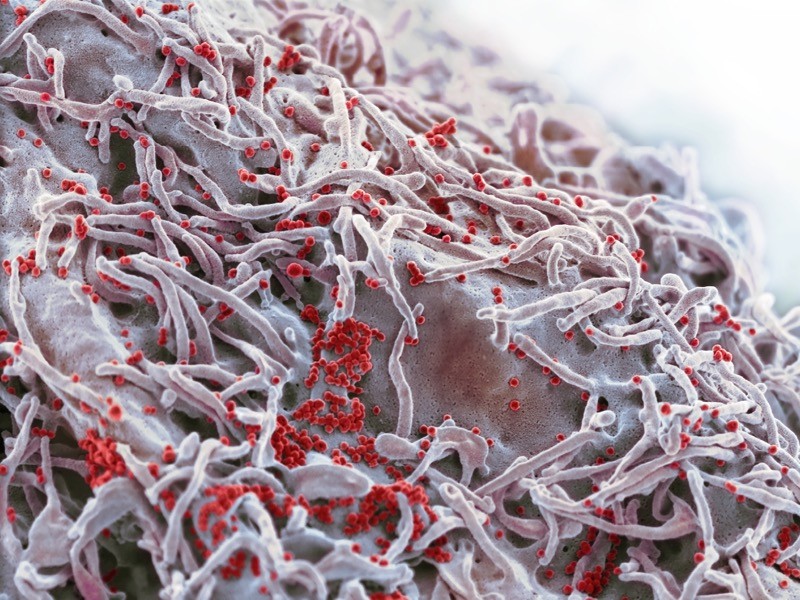 Cell infected with Covid-19 coronavirus particles, SEM.