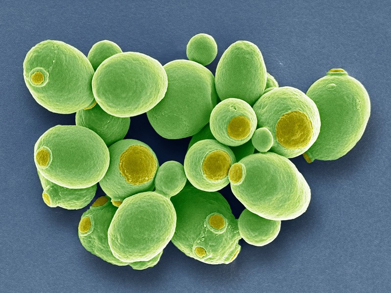 Yeast cells.