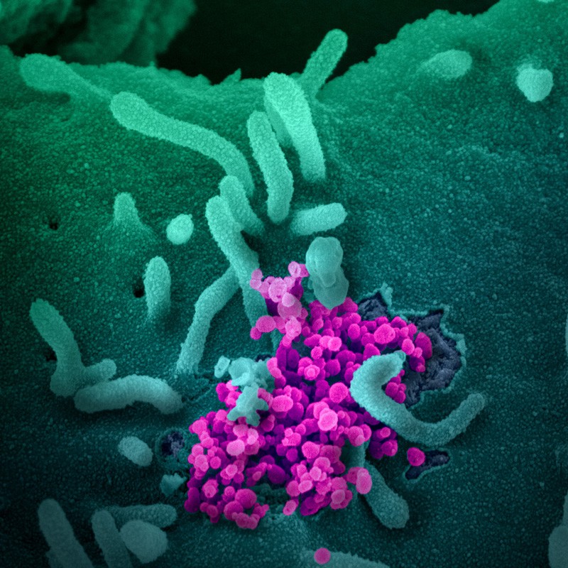 SARS-CoV-2 virus particles show in purple.