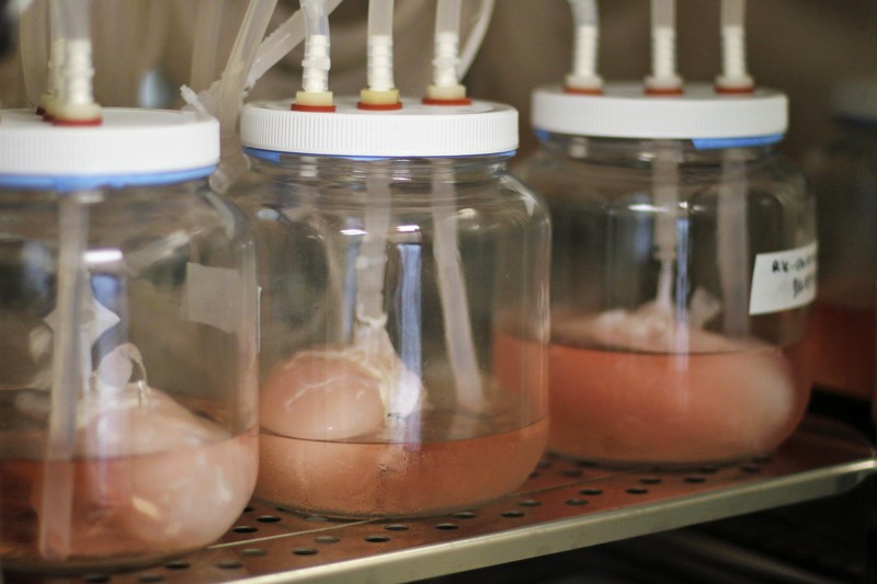 Riñones artificiales biológicos que se desarrollan en biorreactores con forma de frasco