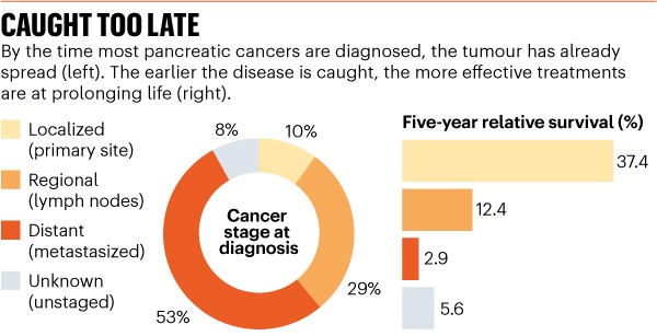 Many pancreatic cancer are detected late