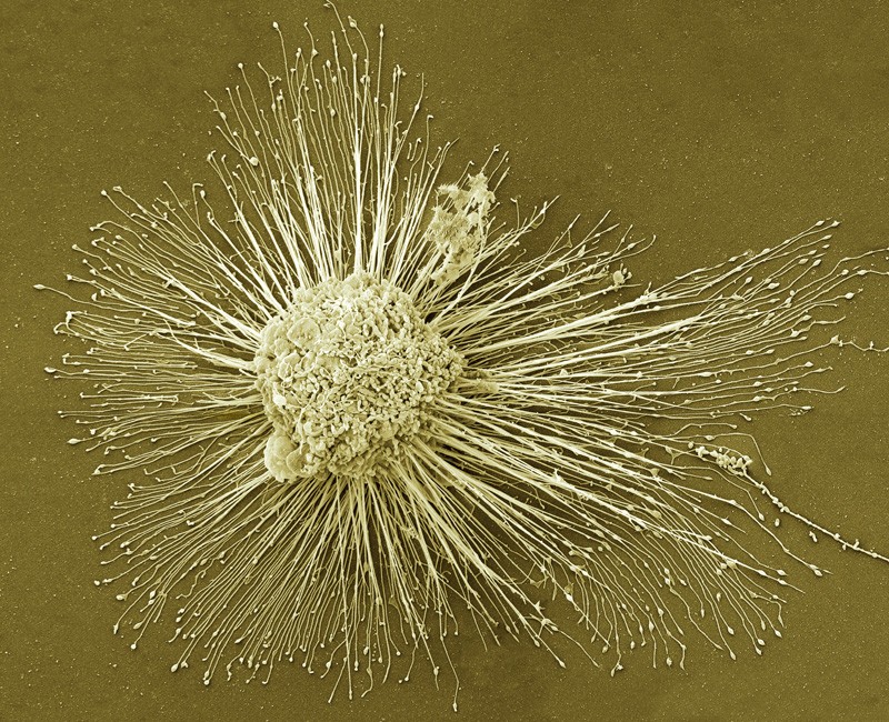Induced pluripotent stem cell, shown in a scanning electron microscope image.