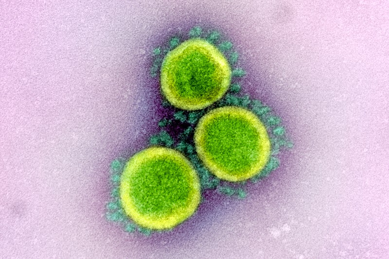 Micrografia eletrônica de transmissão colorida de partículas de coronavírus SARS-CoV-2