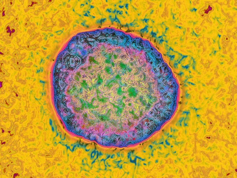 Hepatitis C virus (HCV). HDRI images from an image taken with transmission electron microscopy.