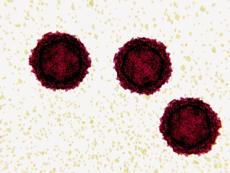 Polio virus particles, illustration.
