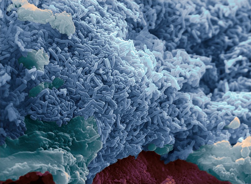 Micrografía de la bacteria Lactobacillus reuteri en forma de bastón en la capa mucosa del intestino delgado humano