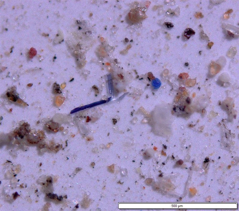 Magnified view of microplastics and other particles that were collected in 11 western national parks and wilderness areas