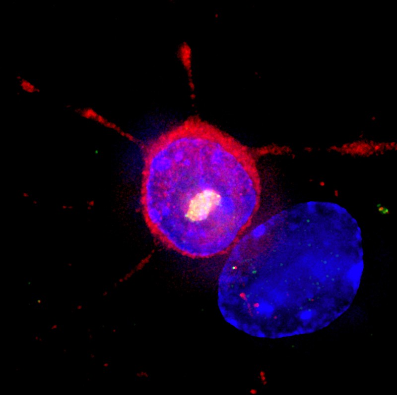 Immunofluorescent light micrograph of a nerve cell from the striatum of the brain